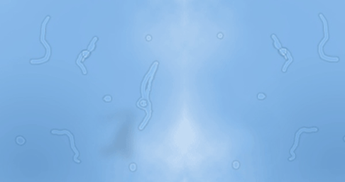 What are those floaty things in your&nbsp;eye?