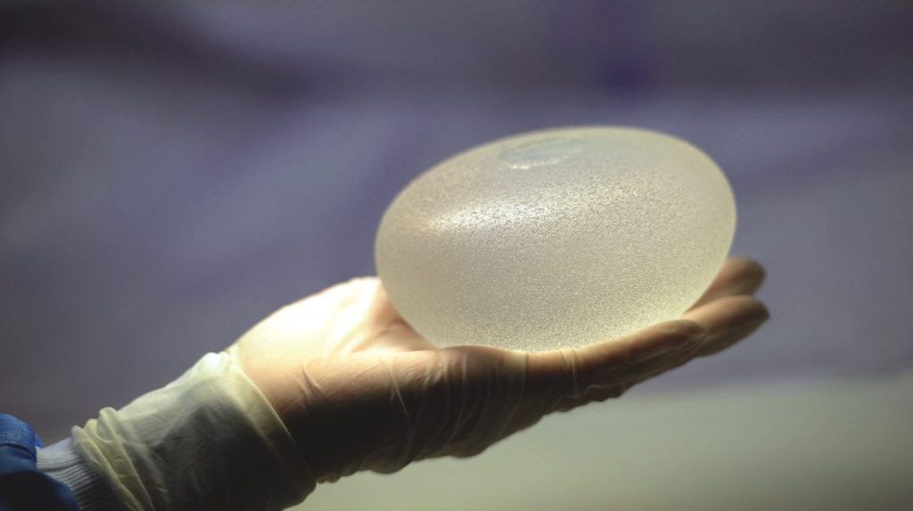 Your body vs.&nbsp;implants